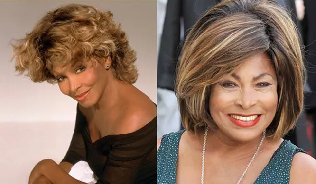 Tina Turner chirurgie esthétique du nez