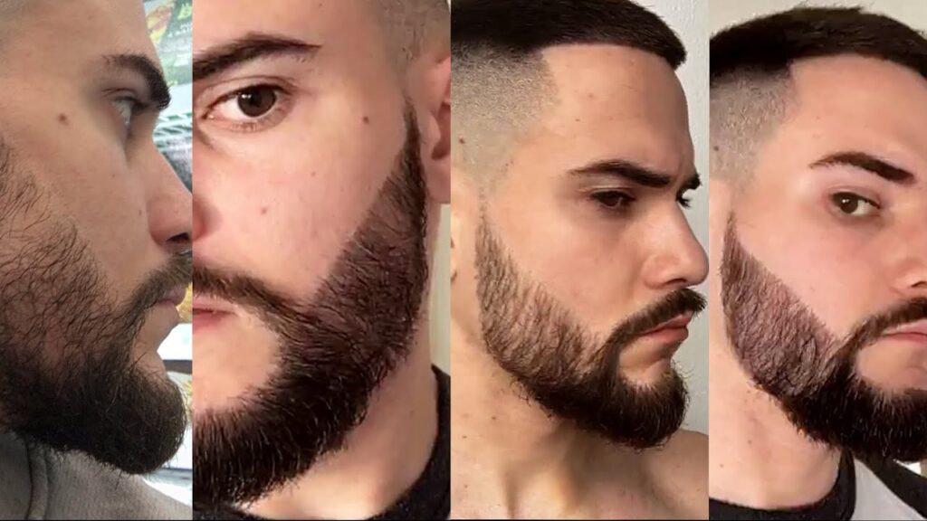 resultat-greffe-barbe-prix-tunisie