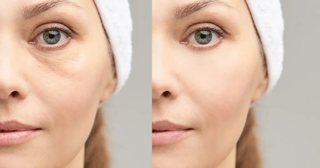 avant-apres-k-beauty