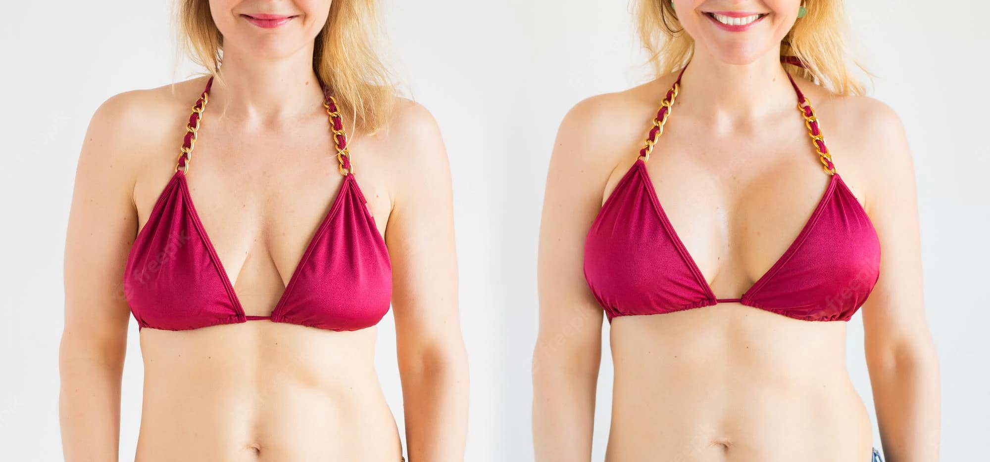 prix-augmentation-mammaire-tunisie-tarifs-implants-et-lipofilling